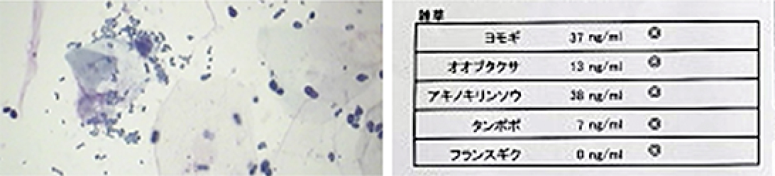 各種ホルモン濃度検査